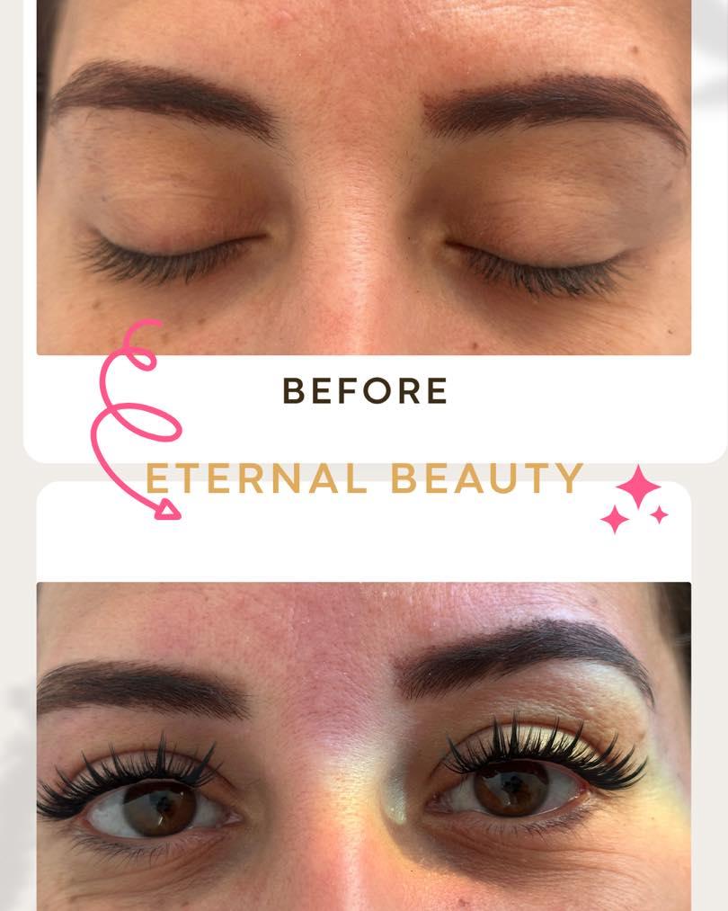 Eternal Beauty 9